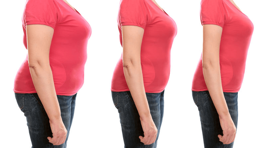Guaranteed Weight Loss With Your Spatz Gastric Balloon Without Surgery